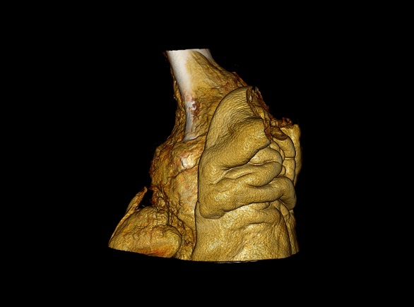 Coronal Opaque - Gorilla Knee.jpg