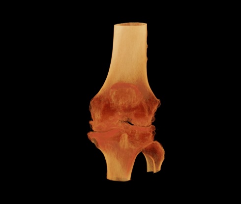 Coronal Transparent - Gorilla Knee.jpg