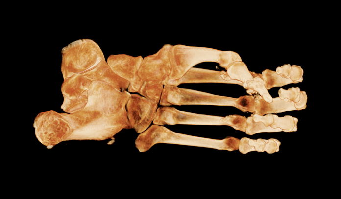 view 3 bones of foot.png